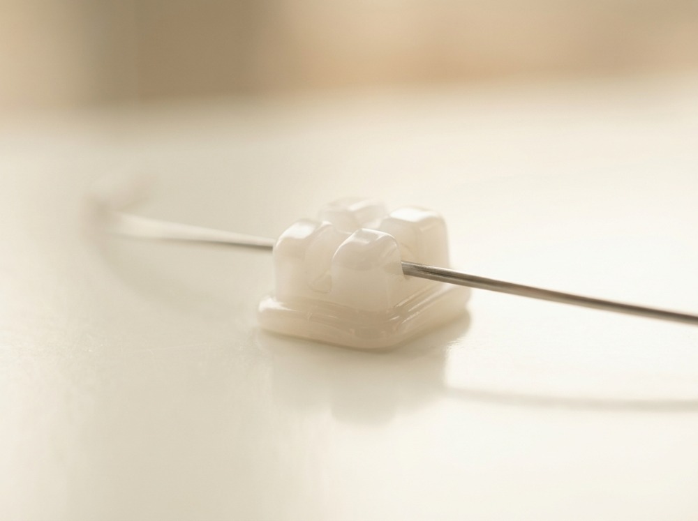 Orthodontic bracket and archwire
